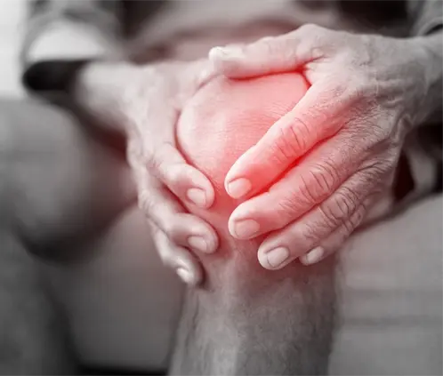 Profeco: 4 formas de darle tratamiento a la Osteoartritis (Foto: Canva) Profeco: 4 formas de darle tratamiento a la Osteoartritis (Foto: Canva)