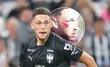 Así fue el terrible accidente de Lucas Ocampos que le provocó una fractura
