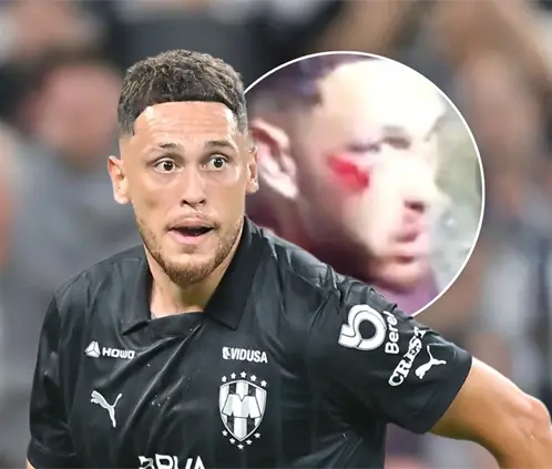 Así fue el terrible accidente de Lucas Ocampos que le provocó una fractura  (Photo by Azael Rodriguez/Getty Images)